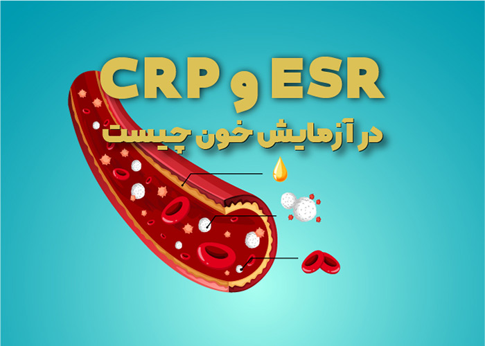 CRP و ESR در آزمایش خون چیست؟