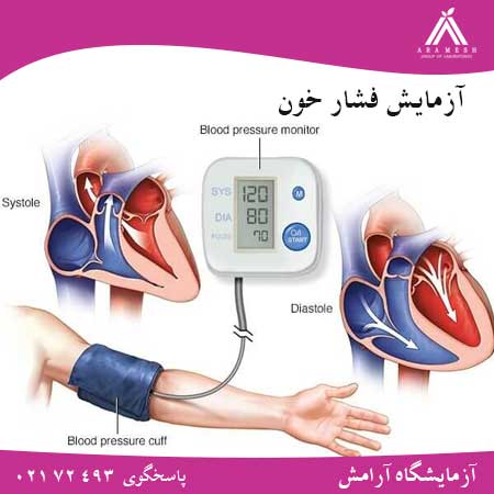 آرمایش فشار خون