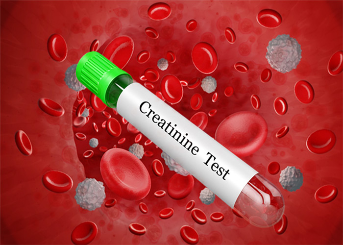 آزمایش کراتینین خون چیست؟ تفسیر کامل