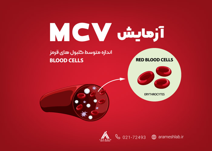 آزمایش خون MCV چیست؟ + کاربرد، تفسیر نتایج و نحوه انجام