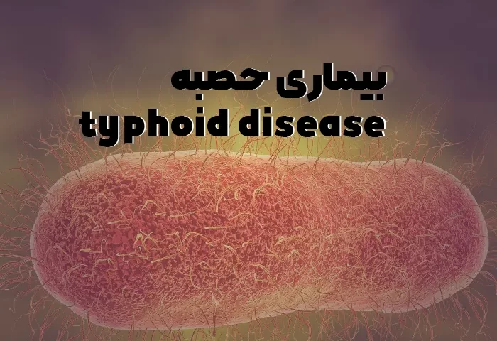 بیماری حصبه یا تب تیفوئید + راهنمای کامل و نحوه درمان