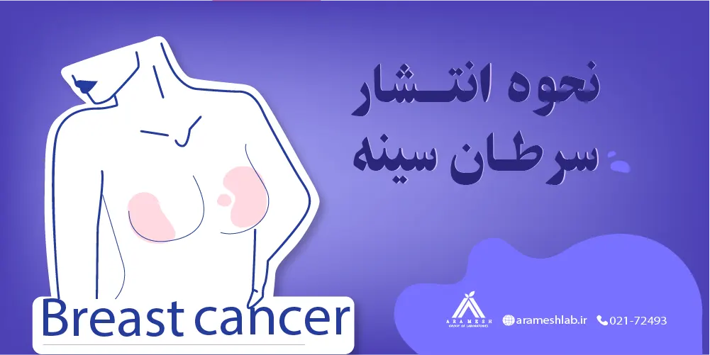 نحوه انتشار سرطان سینه