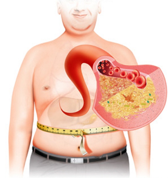 اختلالات متابولیک چیست؟ علل، تشخیص و درمان آزمایشگاه شبانه روزی آرامش